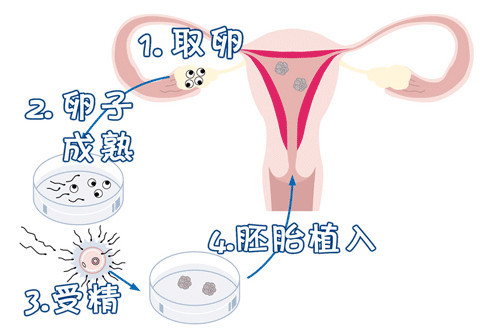 关于暖阳生殖