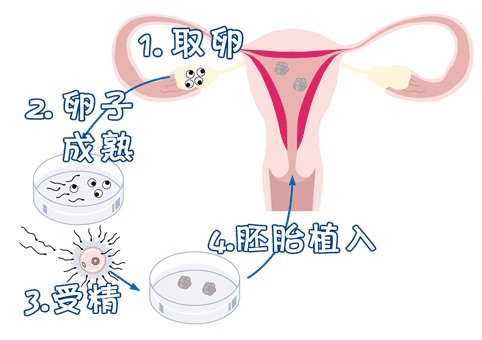 显微操作